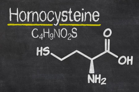 Understanding Your Lab Results: Why You Should Get Your Homocysteine Levels Tested