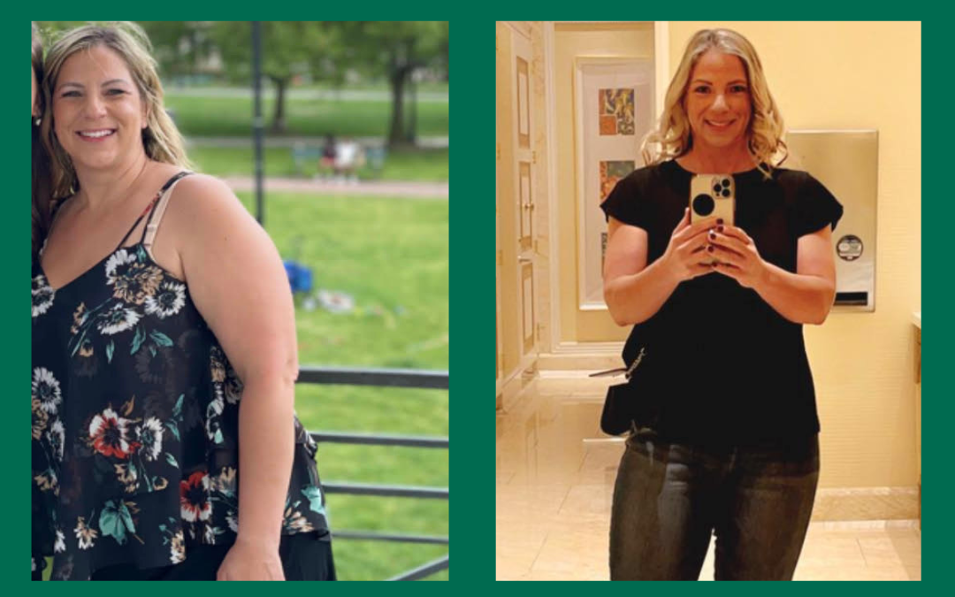 Before and After images of Kim who used functional medicine for weight loss
